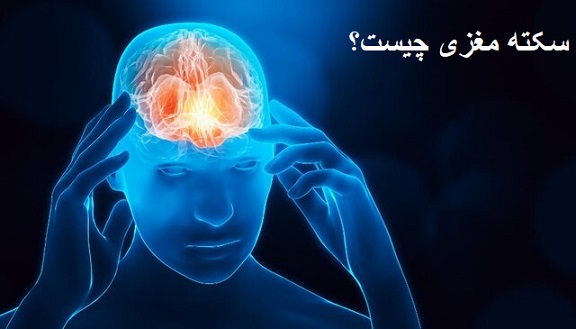 سکته مغزی چیست؟