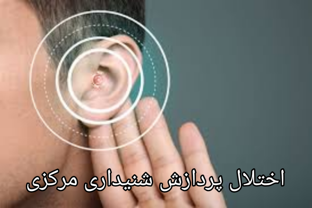 اختلال پردازش شنیداری مرکزی