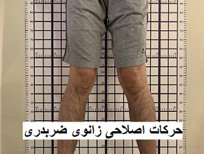 حرکات اصلاحی زانوی ضربدری