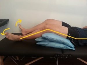 تمرینات کلیدی برای زانوی ضربدری