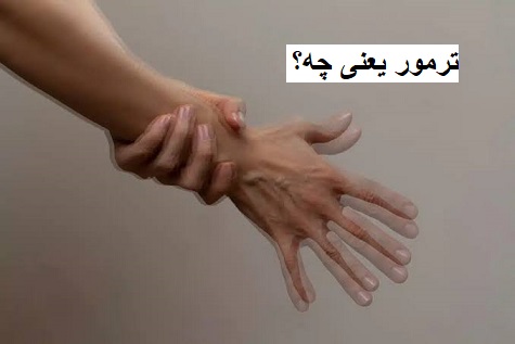 ترمور یعنی چه؟